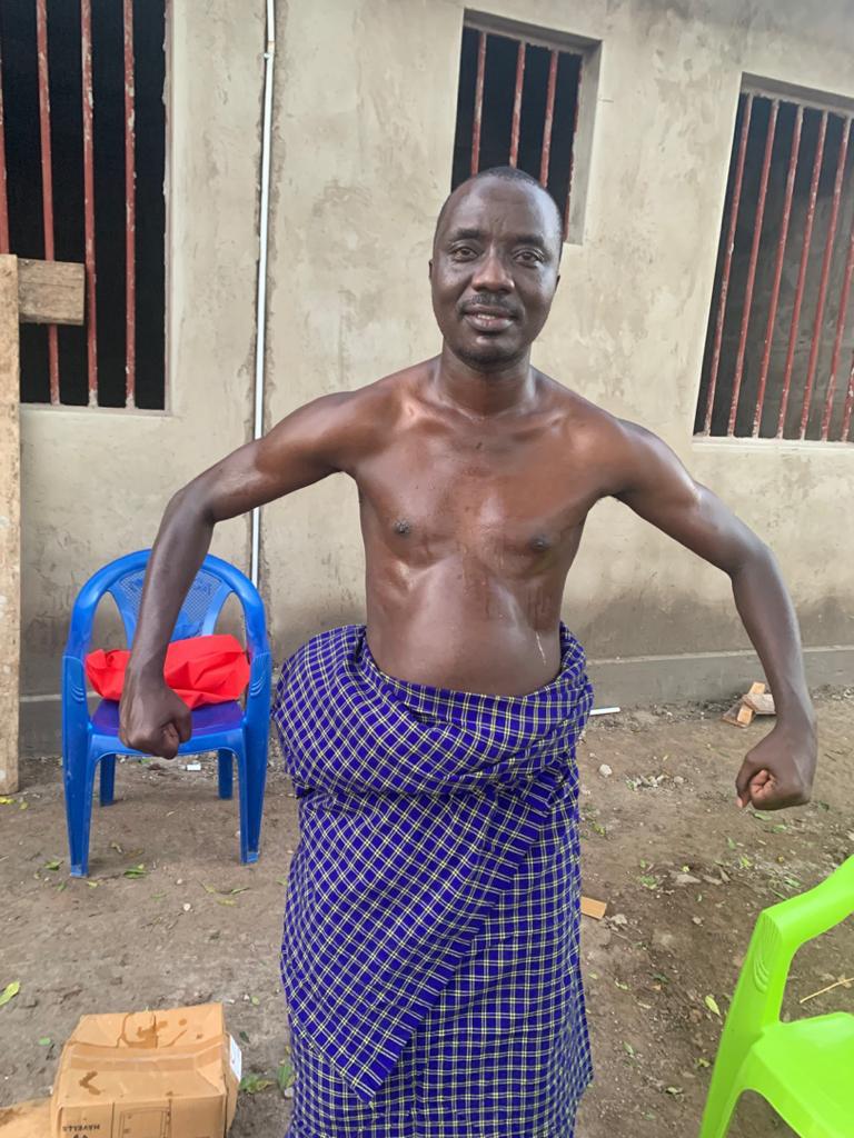 This is a person who was inhaling the steam of eucalyptus leaves (kupiga nyungu) before inhaling the steam, the ribs were tight, and chest, after inhaling the steam of the eucalyptus leaves (kupiga nyungu) the ribs have healed that’s why he is sweating